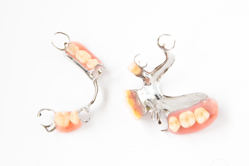 4 solutions pour remplacer une ou plusieurs dents manquantes